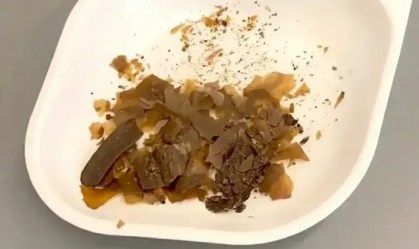 Transferência fecal: romanos antigos faziam cura de fezes, tomilho e azeite