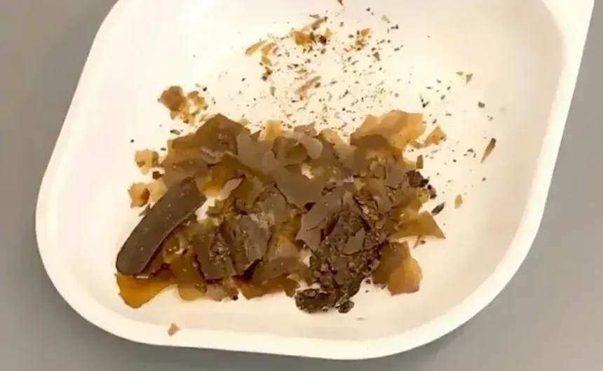 Transferencia fecal: los antiguos romanos elaboraban curas con heces, tomillo y aceite de oliva