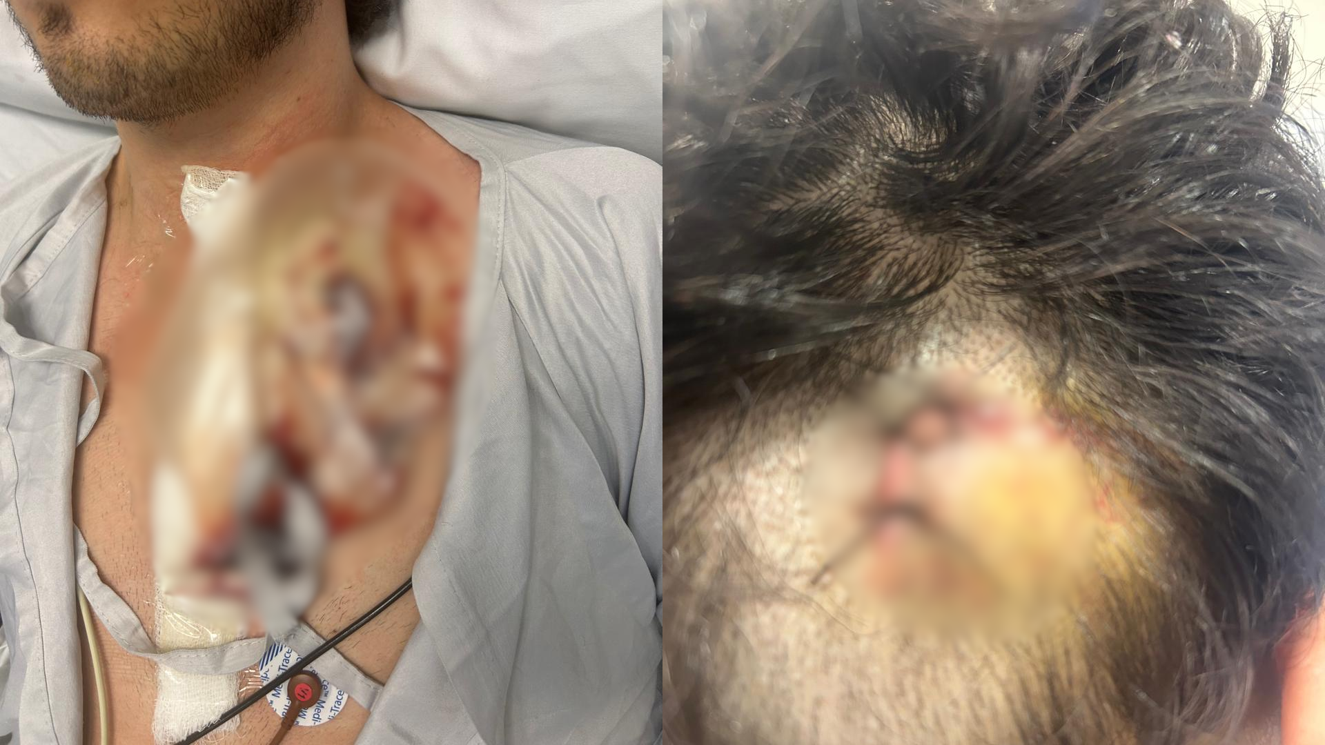 O registro aponta que um dos homens estava com machucados na cabeça e no pescoço, mas seguia consciente