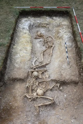 Um dos corpos tinha o crânio trepanado • David Matzliach/Unidade Arqueológica de Cambridge