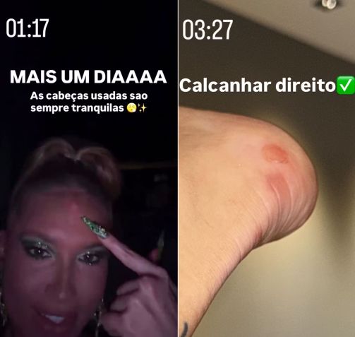 Galo na testa e calcanhar machucado foi o saldo para Virginia após ensaios técnicos do final de semana • Reprodução/Instagram