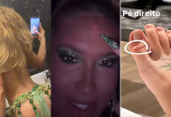 Virginia mostra machucados pelo corpo após ensaio na Grande Rio