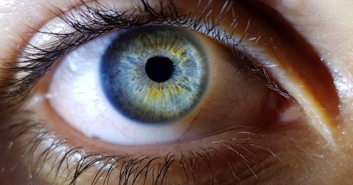 Tecnologia é capaz de detectar anemia a partir dos olhos, diz estudo