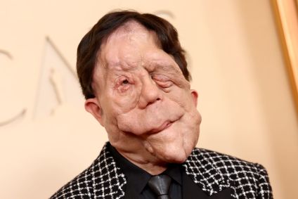 Adam Pearson no tapete vermelhor do Oscar 2026