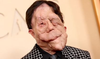 Adam Pearson no tapete vermelhor do Oscar 2026