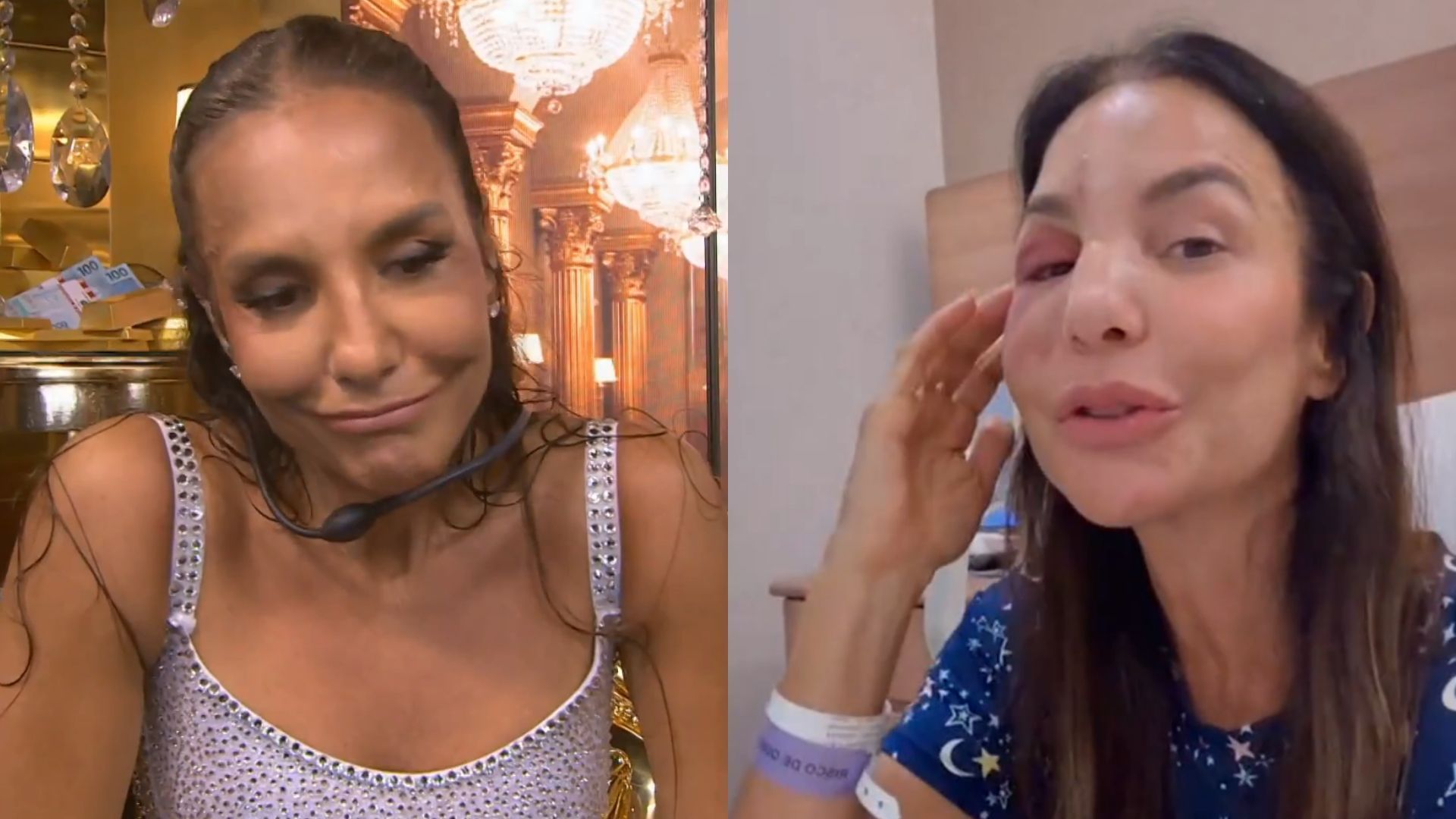 BBB- 26-ivete-sangalo-desabafo-detalhe-acidente