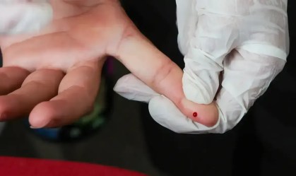 SUS passa a oferecer teste rápido de dengue