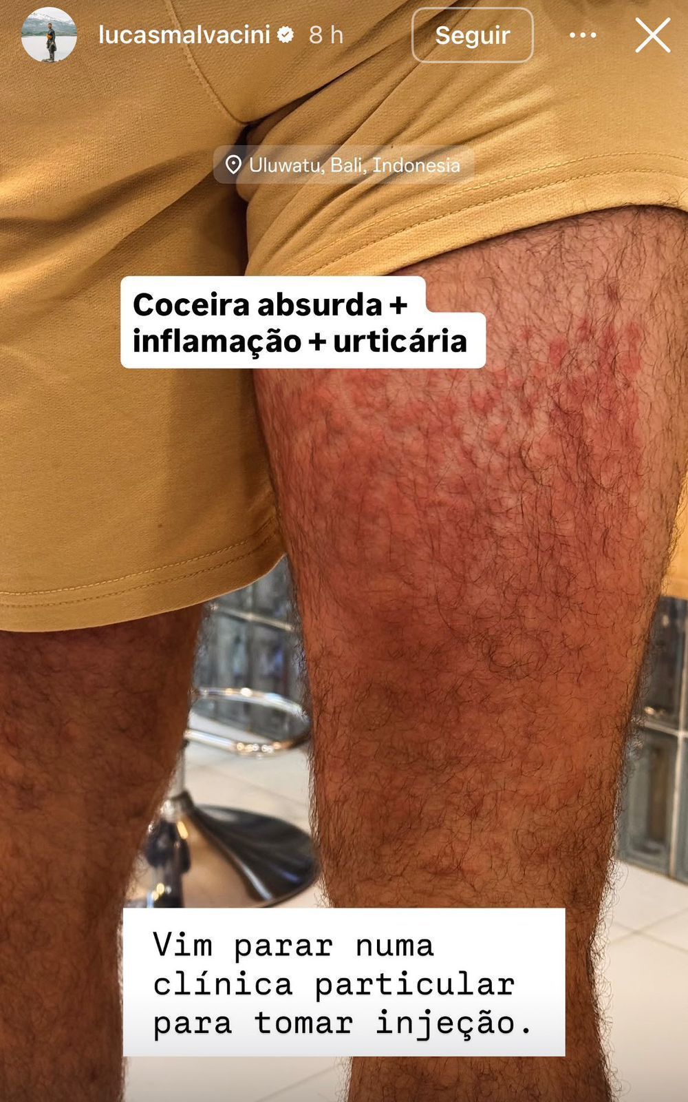 Ator sentou em uma cadeira de palha • Lucas Malvacini / Instagram