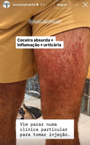 Ator sentou em uma cadeira de palha • Lucas Malvacini / Instagram