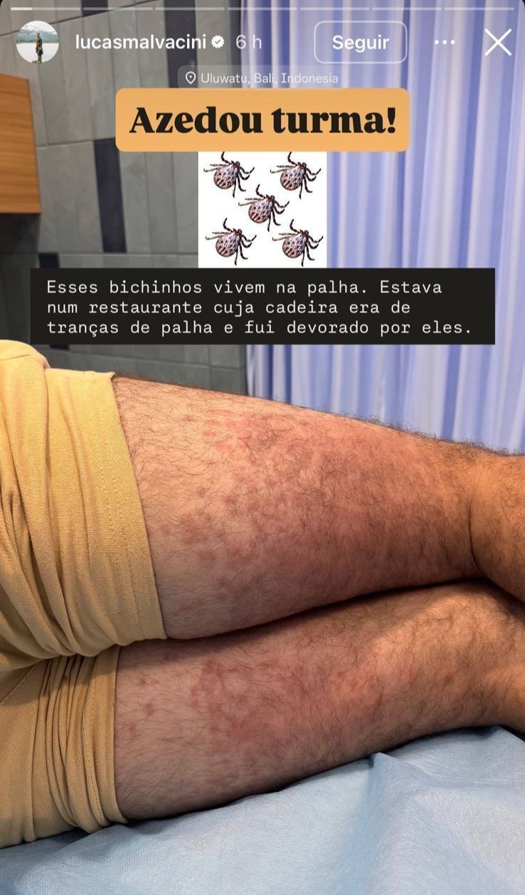 Ator compartilhou relato nas redes sociais • Lucas Malvacini / Instagram