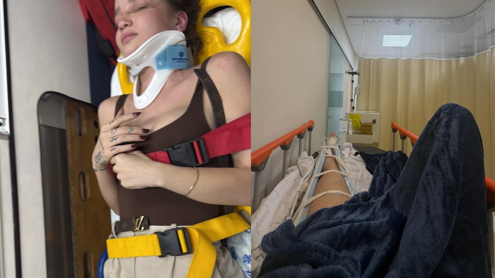 Anna Livya Padilha sofreu um acidente de moto