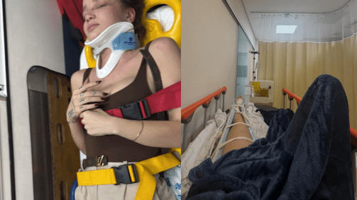 Anna Livya Padilha sofreu um acidente de moto