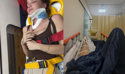 Anna Livya Padilha sofreu um acidente de moto