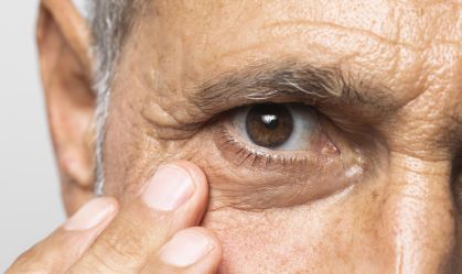 glaucoma