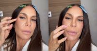 Ivete Sangalo diz que está com presilhas de titânio no rosto após fratura