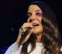 Ivete Sangalo passa por cirurgia no rosto, após queda e desmaio