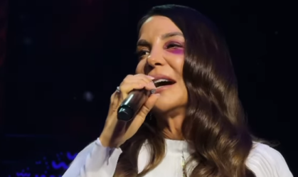 Ivete Sangalo passa por cirurgia no rosto após desmaio seguido de queda