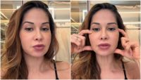 Maíra Cardi conta que fará cirurgia delicada após deformação no rosto