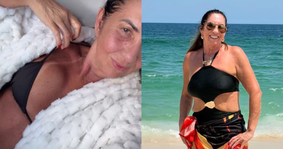 Mãe de Virginia celebra 30 dias de cirurgia com novo procedimento; entenda