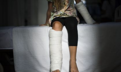 Matriz biocompatível promoveu recuperação de quase 90% do dano sofrido nos testes em laboratório