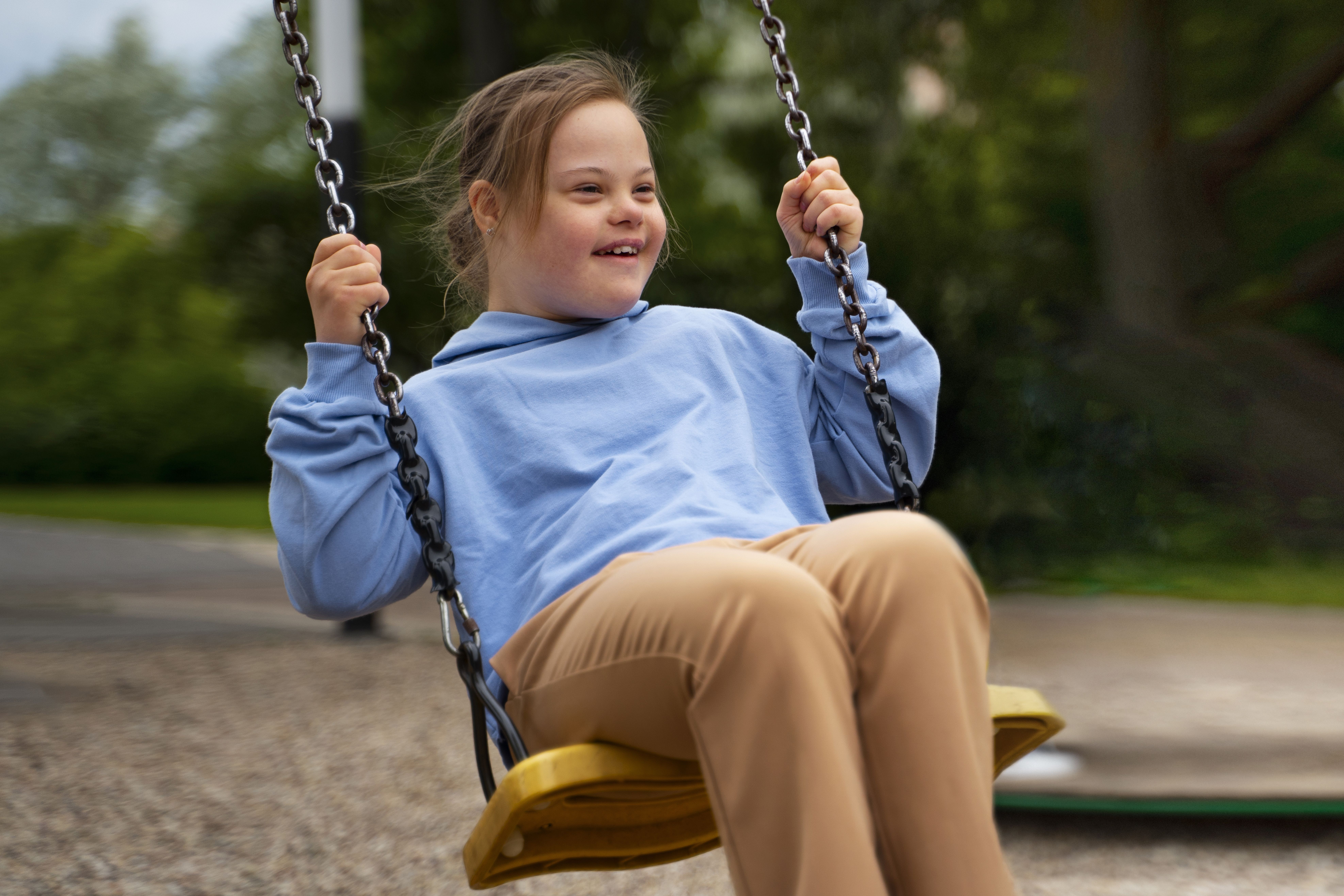 sindrome-de-down