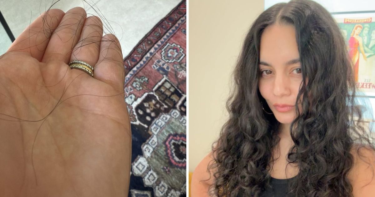 Vanessa Hudgens mostra queda capilar pós-parto: “E assim começa”