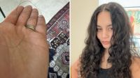 Vanessa Hudgens mostra queda capilar pós-parto: "E assim começa"