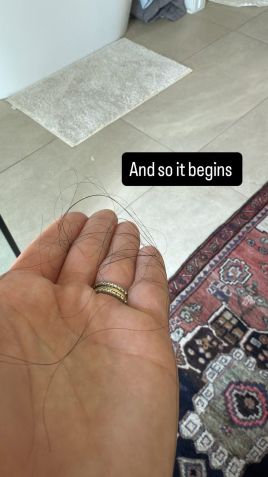 Vanessa Hudgens mostra queda capilar após o parto • Instagram/Vanessa Hudgens