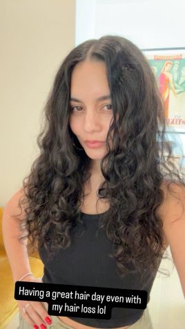 Vanessa Hudgens mostra queda capilar após o parto • Instagram/Vanessa Hudgens