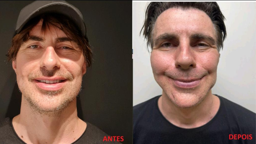 Antes e depois do procedimento realizado pela dentista• Reprodução