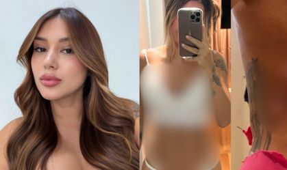 MARIANA TAVARES INFLUENCIADORA CLINICA ESTÉTICA