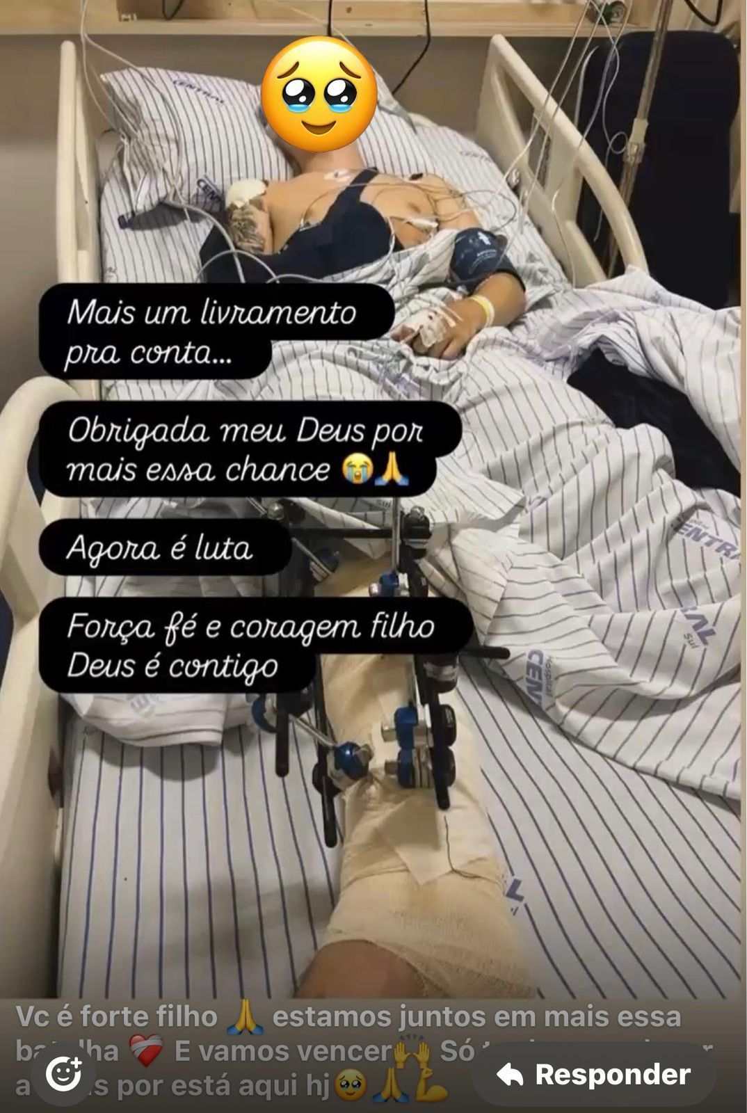 Nas imagens, é possível ver que o jovem sofreu ferimentos no braço e na perna. • Reprodução