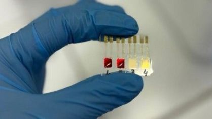 Sensor eletroquímico criado por pesquisadores da USP detecta câncer no pâncreas ainda nos estágios iniciais