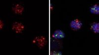 Estudo descobre proteína que protege células de defesa e evita inflamações