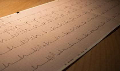 Eletrocardiograma é um dos exames que pode identificar arritmias