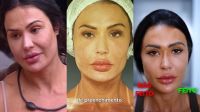 Gracyanne, Kerline e mais: veja ex-BBBs que reverteram procedimentos