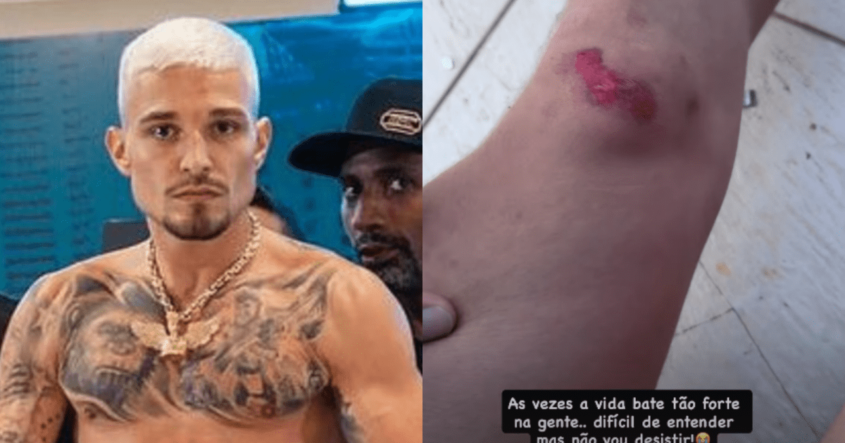 Após incêndio na casa dos pais, MC Gui sofre acidente de moto e se machuca