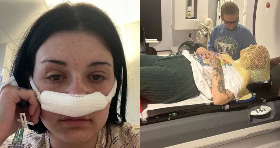 mulher-descobre-tumor