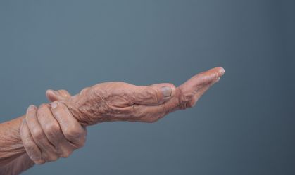 Elderly women with pain.