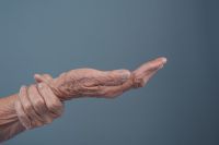Quando considerar a cirurgia no tratamento da doença de Parkinson