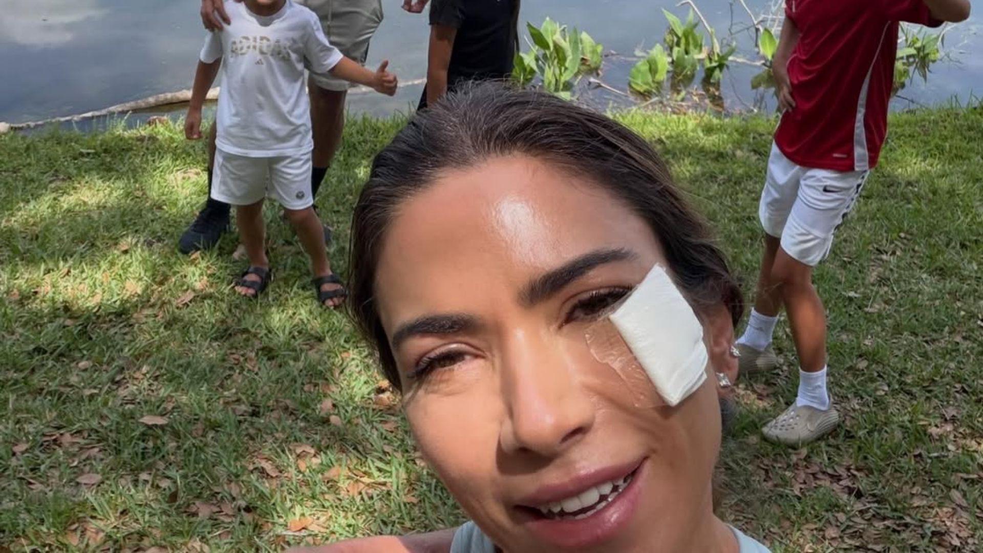 Patricia Abravanel mostrou machucado no rosto • Reprodução/Instagram