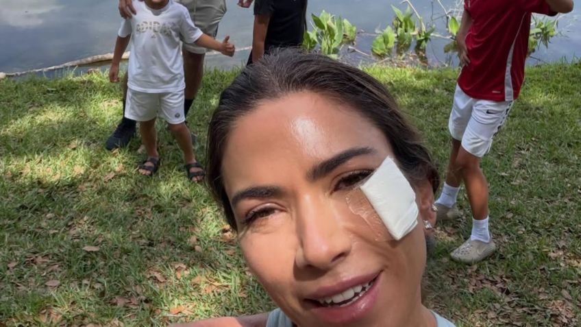 Patricia Abravanel mostrou machucado no rosto • Reprodução/Instagram