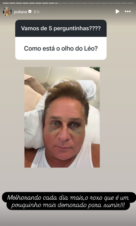 Poliana Rocha mostra evolução de hematomas de Leonardo • Instagram/Poliana Rocha
