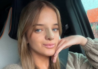 Rafa Justus diz que teve de tirar cartilagem da costela para rinoplastia