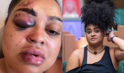 Rizia Cerqueira sofreu acidente enquanto dirigia uma moto elétrica
