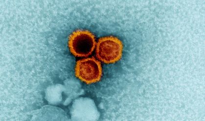 Epstein-barr virus particles