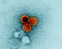 Conheça vírus presente em 95% da população e que pode causar doenças sérias