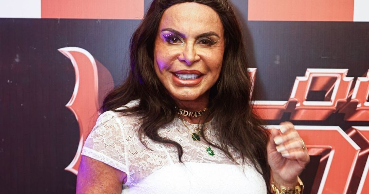 Gretchen fala sobre alopecia progressiva: “Mexe muito com minha autoestima”