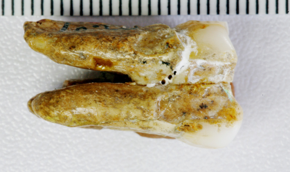 porteínas de dentes de homo erectus são encontrados também em dentes de humanos modernos