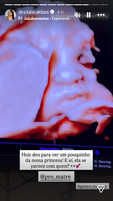 Laís Caldas e Gustavo Marsengo revelam rosto da primeira filha • Reprodução Instagram/Laís Caldas